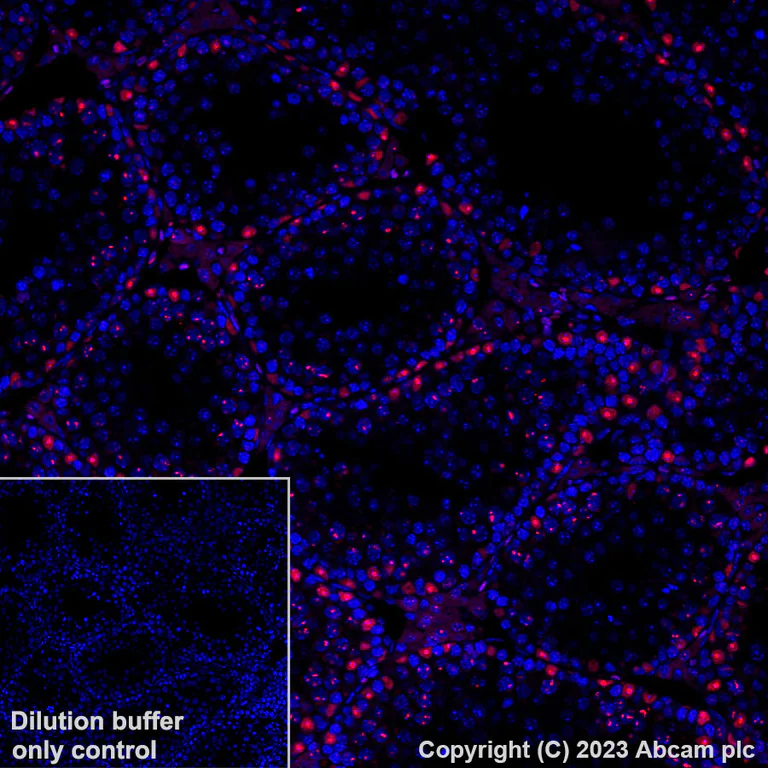 Immunohistochemistry (Formalin/PFA-fixed paraffin-embedded sections) - Alexa Fluor® 555 Anti-Wilms Tumor Protein antibody [CAN-R9(IHC)-56-2] (AB314587)