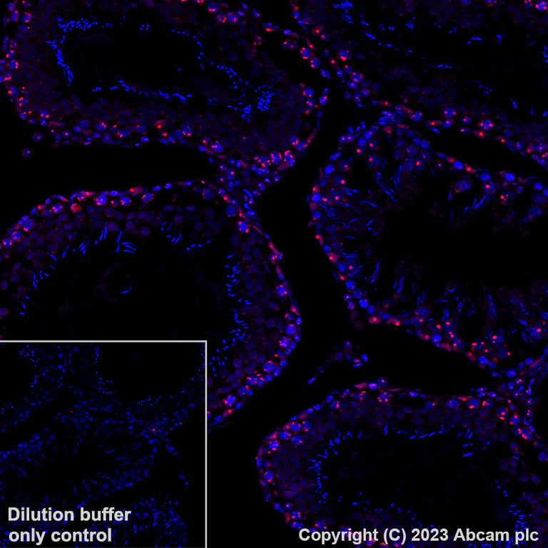 Immunohistochemistry (Formalin/PFA-fixed paraffin-embedded sections) - Alexa Fluor® 555 Anti-Wilms Tumor Protein antibody [CAN-R9(IHC)-56-2] (AB314587)
