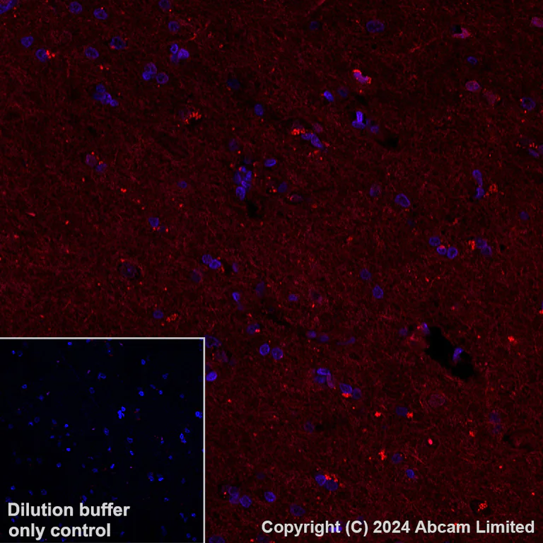 Immunohistochemistry (Formalin/PFA-fixed paraffin-embedded sections) - Alexa Fluor® 568 Anti-ADAM22 antibody [EPR28037-56] (AB319190)