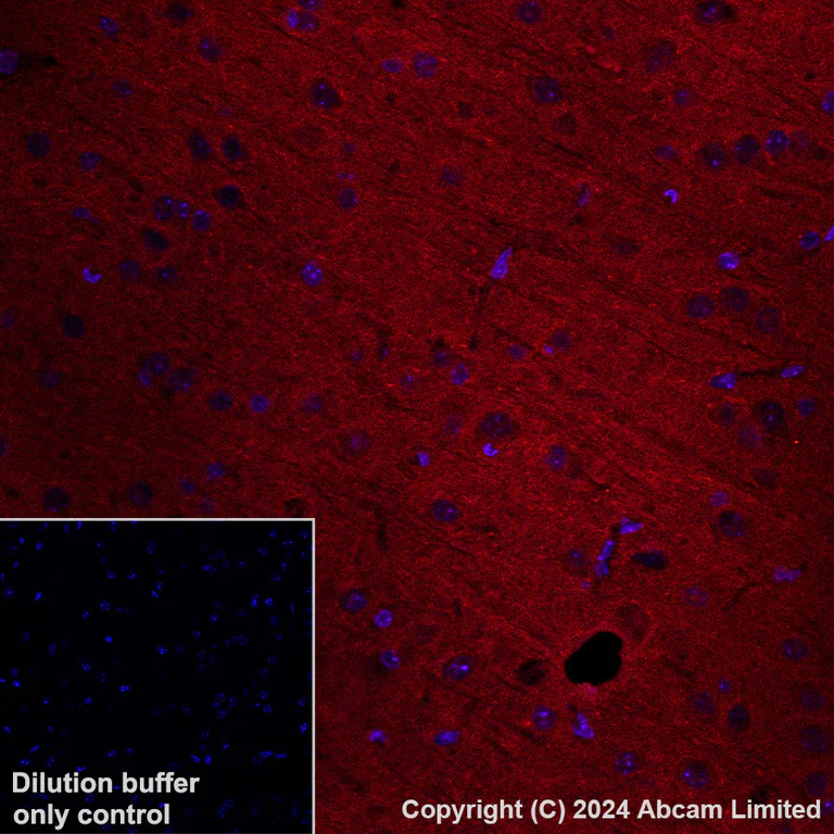 Immunohistochemistry (Formalin/PFA-fixed paraffin-embedded sections) - Alexa Fluor® 568 Anti-ADAM22 antibody [EPR28037-56] (AB319190)