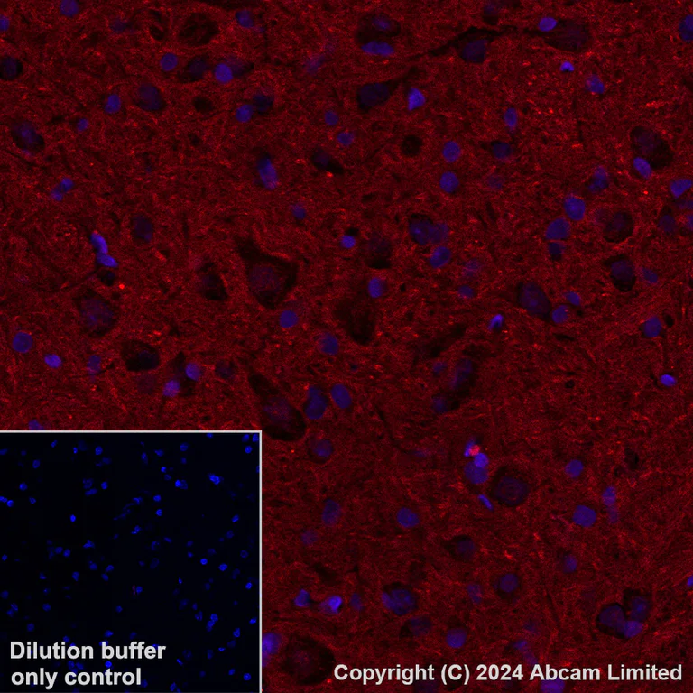 Immunohistochemistry (Formalin/PFA-fixed paraffin-embedded sections) - Alexa Fluor® 568 Anti-ADAM22 antibody [EPR28037-56] (AB319190)