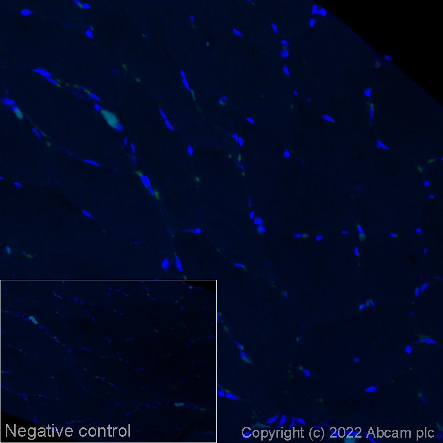 Immunohistochemistry (Formalin/PFA-fixed paraffin-embedded sections) - Alexa Fluor® 568 Anti-Alpha-synuclein (phospho S129) antibody [EP1536Y] (AB307166), expandable thumbnail