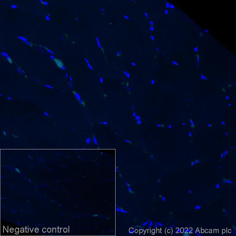 Immunohistochemistry (Formalin/PFA-fixed paraffin-embedded sections) - Alexa Fluor® 568 Anti-Alpha-synuclein (phospho S129) antibody [EP1536Y] (AB307166)
