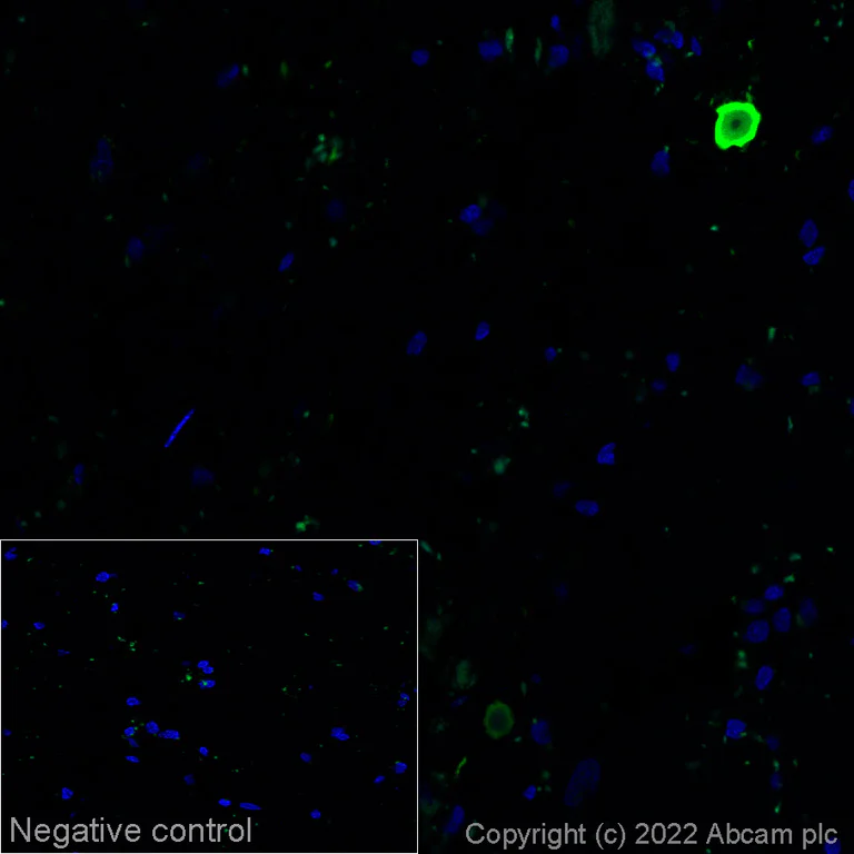 Immunohistochemistry (Frozen sections) - Alexa Fluor® 568 Anti-Alpha-synuclein (phospho S129) antibody [EP1536Y] (AB307166)