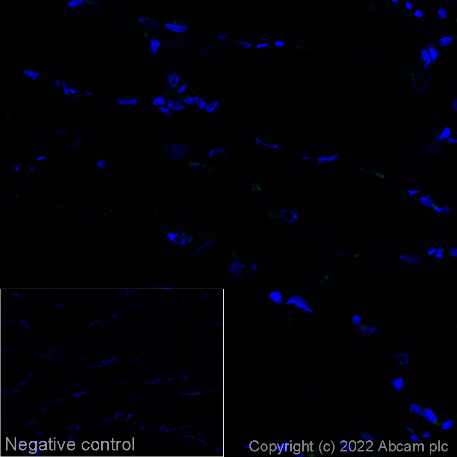 Immunohistochemistry (Frozen sections) - Alexa Fluor® 568 Anti-Alpha-synuclein (phospho S129) antibody [EP1536Y] (AB307166), expandable thumbnail