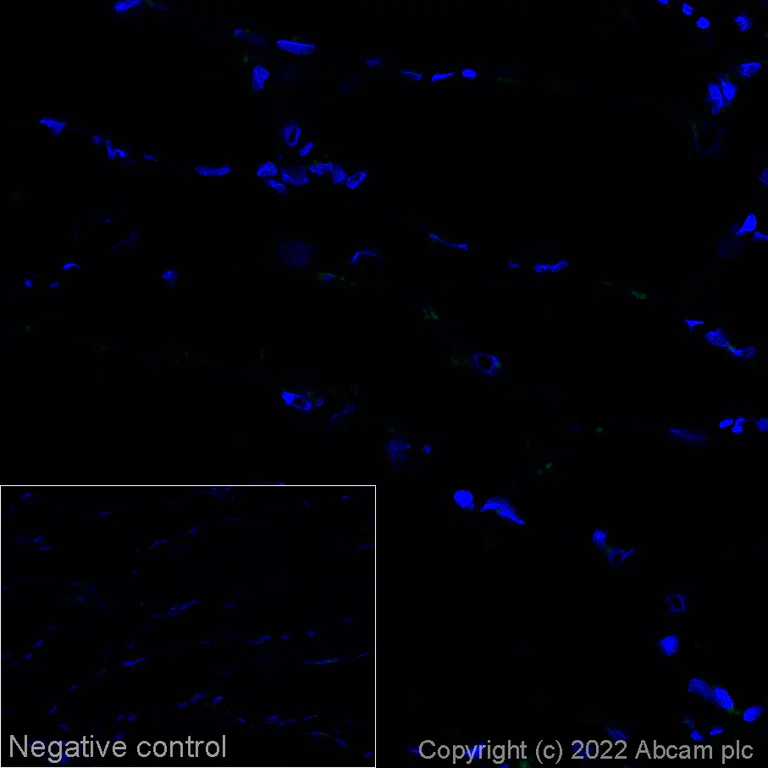 Immunohistochemistry (Frozen sections) - Alexa Fluor® 568 Anti-Alpha-synuclein (phospho S129) antibody [EP1536Y] (AB307166)