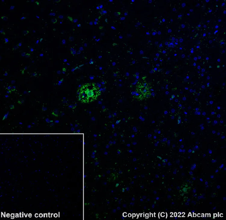 Immunohistochemistry (Formalin/PFA-fixed paraffin-embedded sections) - Alexa Fluor® 568 Anti-beta Amyloid 1-42 antibody [mOC64] (AB302803)