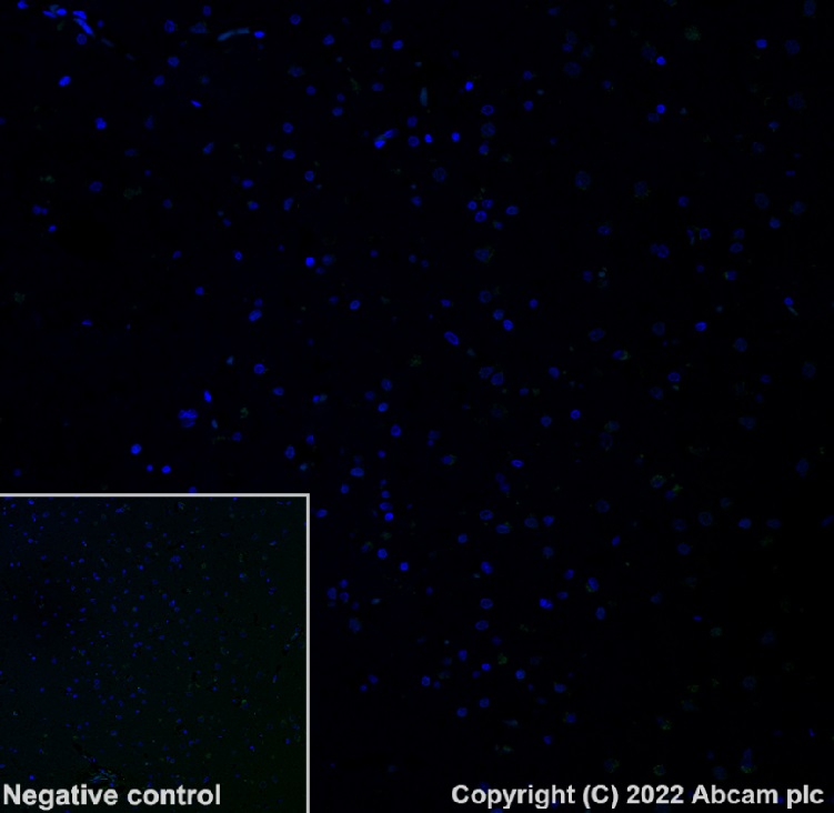 Immunohistochemistry (Formalin/PFA-fixed paraffin-embedded sections) - Alexa Fluor® 568 Anti-beta Amyloid 1-42 antibody [mOC64] (AB302803), expandable thumbnail