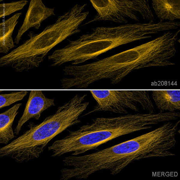 Immunocytochemistry/ Immunofluorescence - Alexa Fluor® 568 Anti-beta Tubulin antibody [EPR16774] - Microtubule Marker (AB208144)