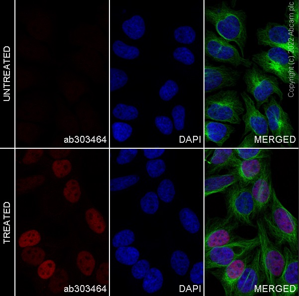 Immunocytochemistry/ Immunofluorescence - Alexa Fluor® 568 Anti-c-Fos antibody [EPR21930-238] (AB303464), expandable thumbnail