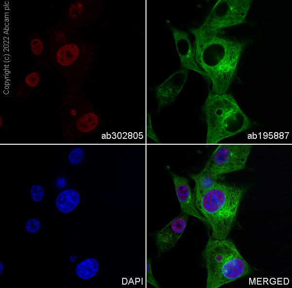 Immunocytochemistry/ Immunofluorescence - Alexa Fluor® 568 Anti-Choline Acetyltransferase antibody [EPR13024(B)] (AB302805), expandable thumbnail
