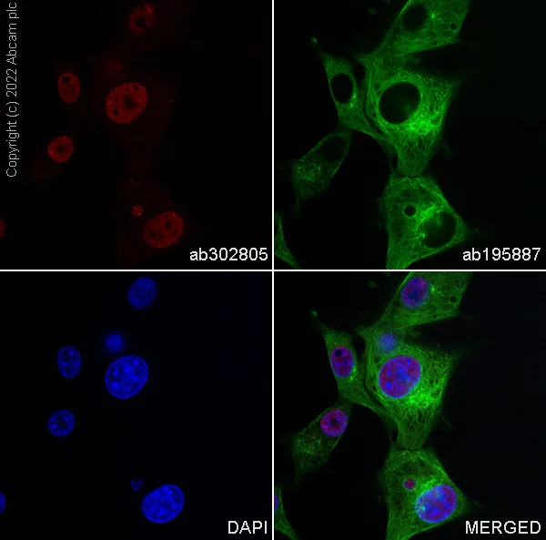Immunocytochemistry/ Immunofluorescence - Alexa Fluor® 568 Anti-Choline Acetyltransferase antibody [EPR13024(B)] (AB302805)