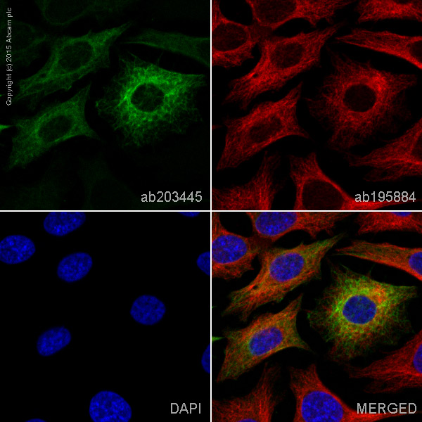 Immunocytochemistry/ Immunofluorescence - Alexa Fluor® 568 Anti-Cytokeratin 19 antibody [EP1580Y] (AB203445)
