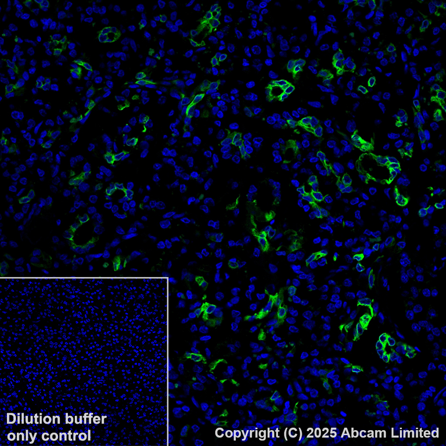 Immunohistochemistry (Formalin/PFA-fixed paraffin-embedded sections) - Alexa Fluor® 568 Anti-Cytokeratin 19 antibody [EP1580Y] (AB203445)