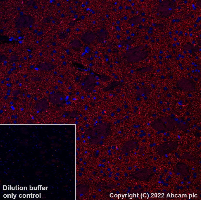 Immunohistochemistry (Formalin/PFA-fixed paraffin-embedded sections) - Alexa Fluor® 568 Anti-Dopamine Transporter antibody [EPR19695] (AB303466), expandable thumbnail