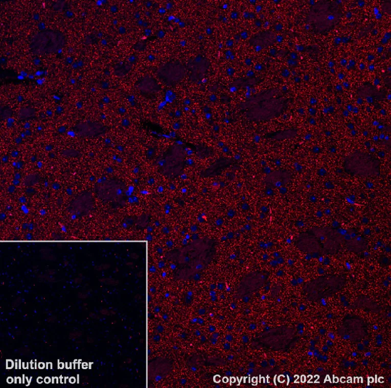 Immunohistochemistry (Formalin/PFA-fixed paraffin-embedded sections) - Alexa Fluor® 568 Anti-Dopamine Transporter antibody [EPR19695] (AB303466)