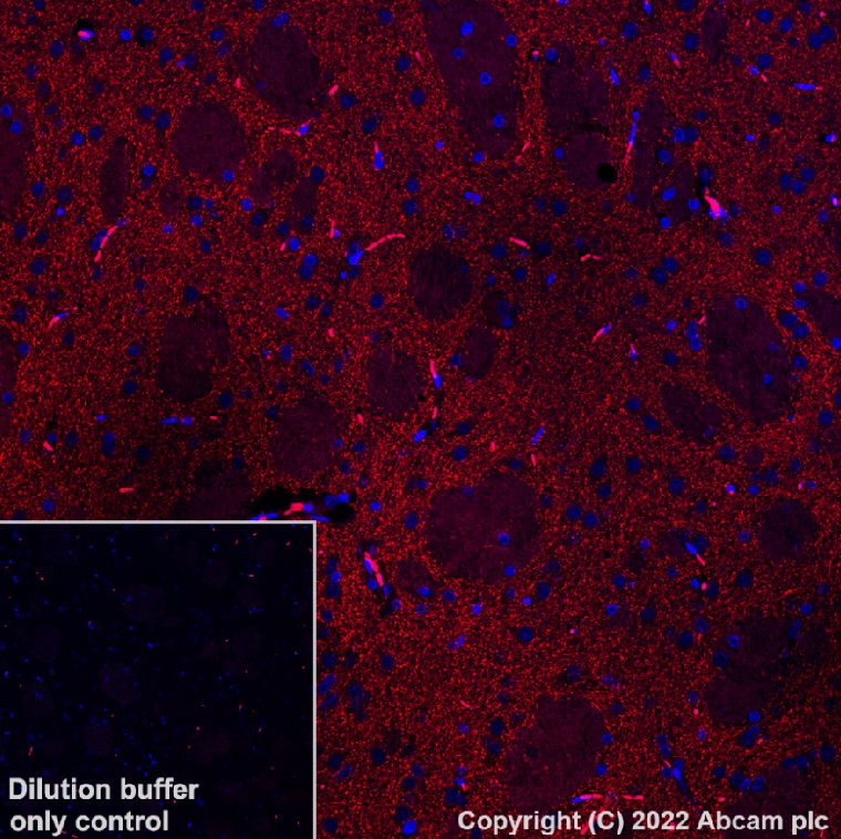 Immunohistochemistry (Formalin/PFA-fixed paraffin-embedded sections) - Alexa Fluor® 568 Anti-Dopamine Transporter antibody [EPR19695] (AB303466), expandable thumbnail