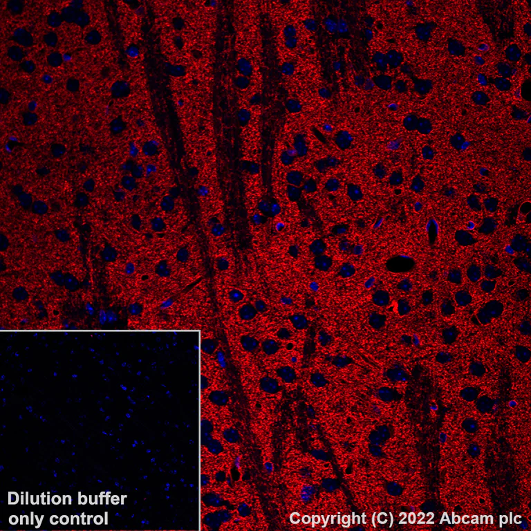 Immunohistochemistry (Formalin/PFA-fixed paraffin-embedded sections) - Alexa Fluor® 568 Anti-EAAT2 antibody [EPR19798] (AB313820)