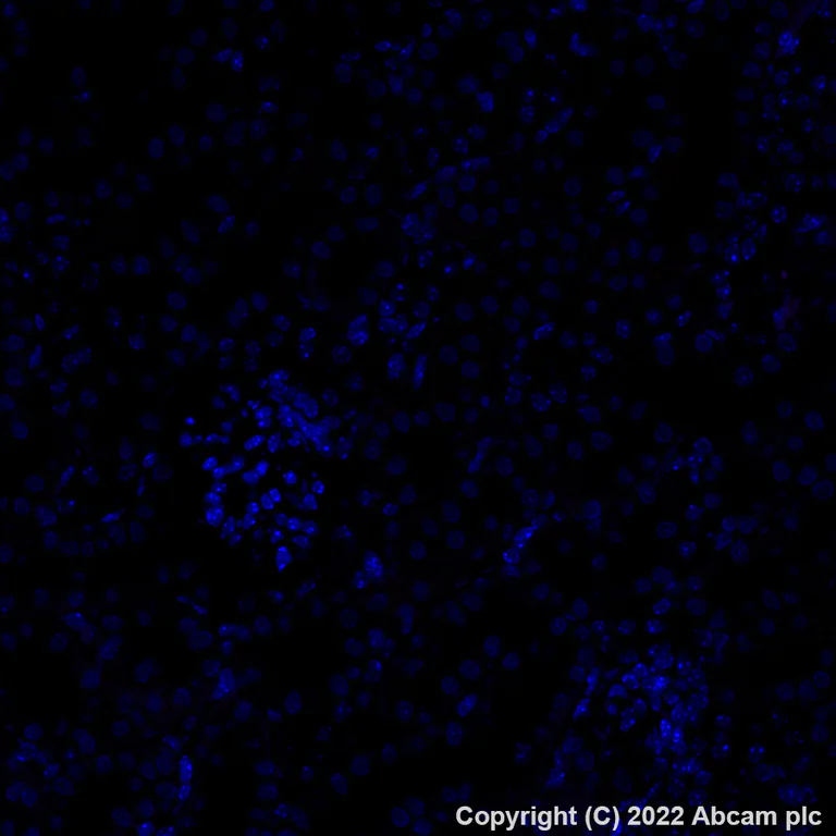 Immunohistochemistry (Formalin/PFA-fixed paraffin-embedded sections) - Alexa Fluor® 568 Anti-EAAT2 antibody [EPR19798] (AB313820)