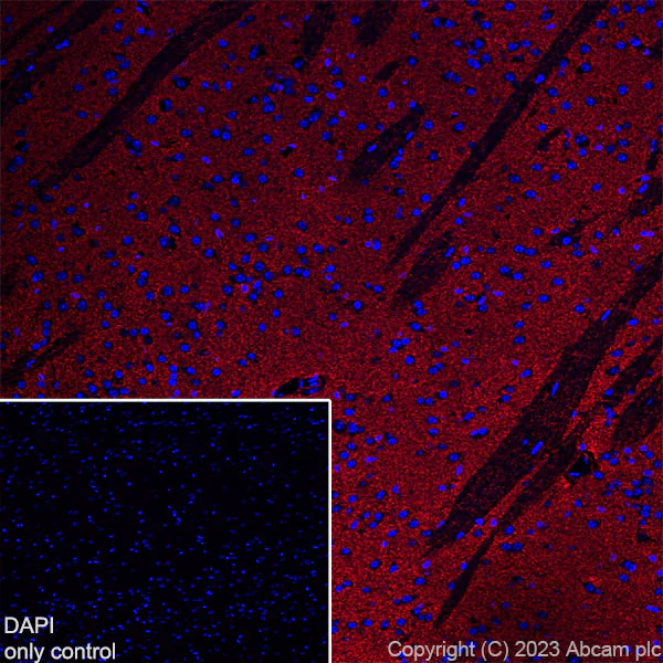 Immunohistochemistry (Frozen sections) - Alexa Fluor® 568 Anti-EAAT2 antibody [EPR19798] (AB313820)