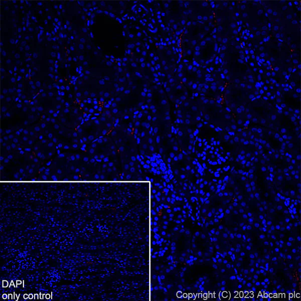 Immunohistochemistry (Frozen sections) - Alexa Fluor® 568 Anti-EAAT2 antibody [EPR19798] (AB313820)