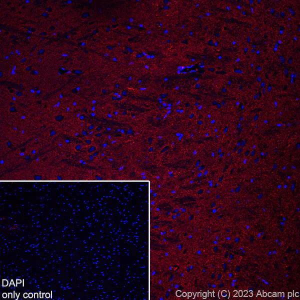 Immunohistochemistry (Frozen sections) - Alexa Fluor® 568 Anti-EAAT2 antibody [EPR19798] (AB313820)
