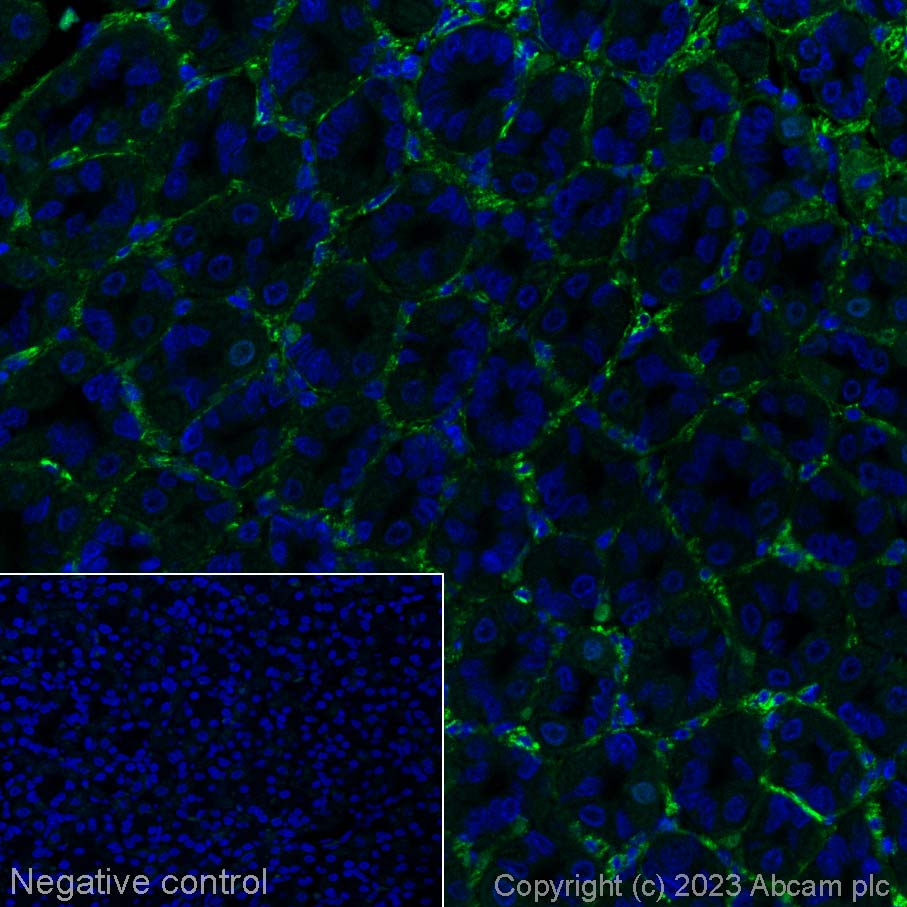 Immunohistochemistry (Formalin/PFA-fixed paraffin-embedded sections) - Alexa Fluor® 568 Anti-Fibronectin antibody [EPR19241-46] (AB314284), expandable thumbnail