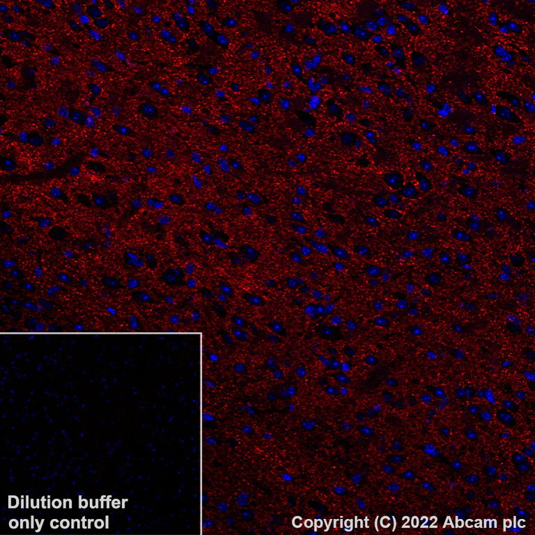 Immunohistochemistry (Formalin/PFA-fixed paraffin-embedded sections) - Alexa Fluor® 568 Anti-GAD65 antibody [EPR22952-70] (AB307856)