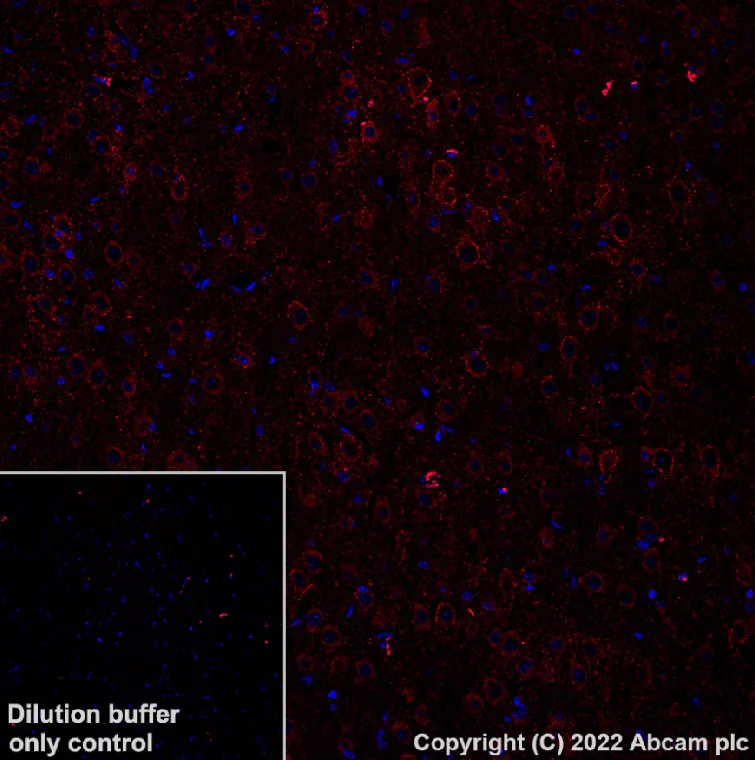 Immunohistochemistry (Formalin/PFA-fixed paraffin-embedded sections) - Alexa Fluor® 568 Anti-GAD67/GAD1 antibody [EPR20578] (AB303463)
