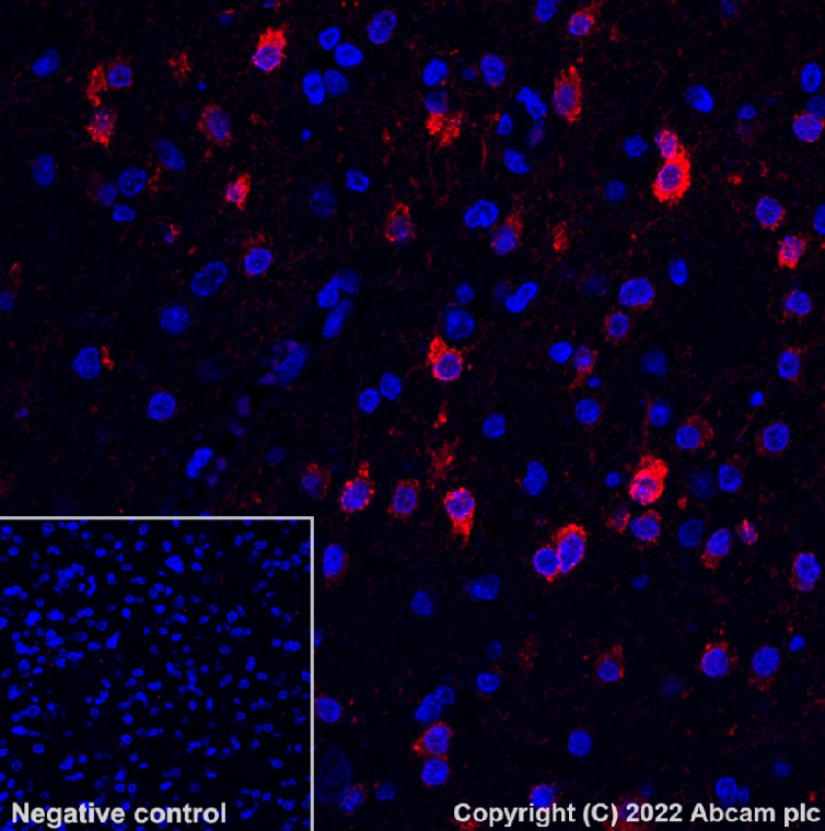 Immunohistochemistry (Formalin/PFA-fixed paraffin-embedded sections) - Alexa Fluor® 568 Anti-Glutamine Synthetase antibody [EPR13022(B)] (AB302807), expandable thumbnail
