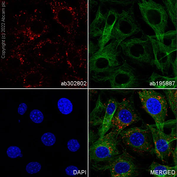 Immunocytochemistry/ Immunofluorescence - Alexa Fluor® 568 Anti-LAMP1 antibody [EPR21026] - Lysosome Marker (AB302802)