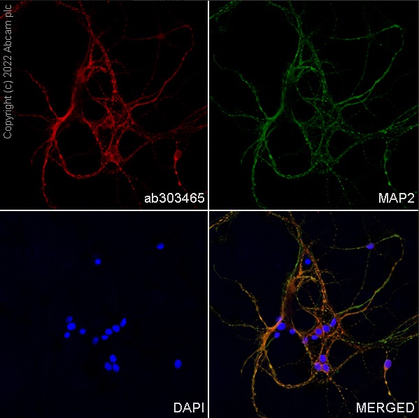 Immunocytochemistry/ Immunofluorescence - Alexa Fluor® 568 Anti-MAP2 antibody [EPR19691] (ab303465), expandable thumbnail