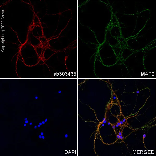 Immunocytochemistry/ Immunofluorescence - Alexa Fluor® 568 Anti-MAP2 antibody [EPR19691] - Neuronal Marker (AB303465)