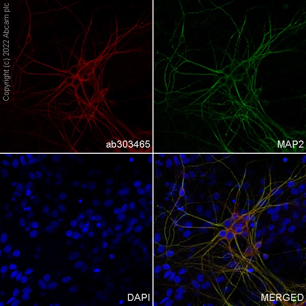 Immunocytochemistry/ Immunofluorescence - Alexa Fluor® 568 Anti-MAP2 antibody [EPR19691] (ab303465), expandable thumbnail
