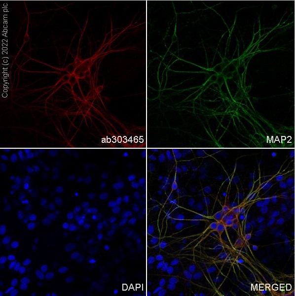 Immunocytochemistry/ Immunofluorescence - Alexa Fluor® 568 Anti-MAP2 antibody [EPR19691] (AB303465), expandable thumbnail