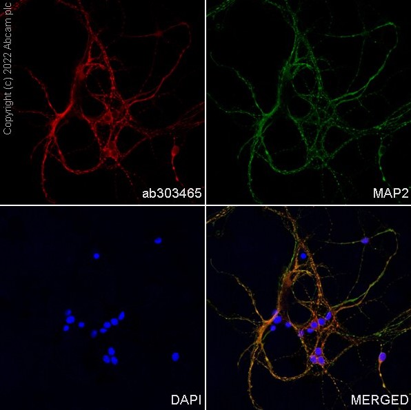 Immunocytochemistry/ Immunofluorescence - Alexa Fluor® 568 Anti-MAP2 antibody [EPR19691] (AB303465), expandable thumbnail