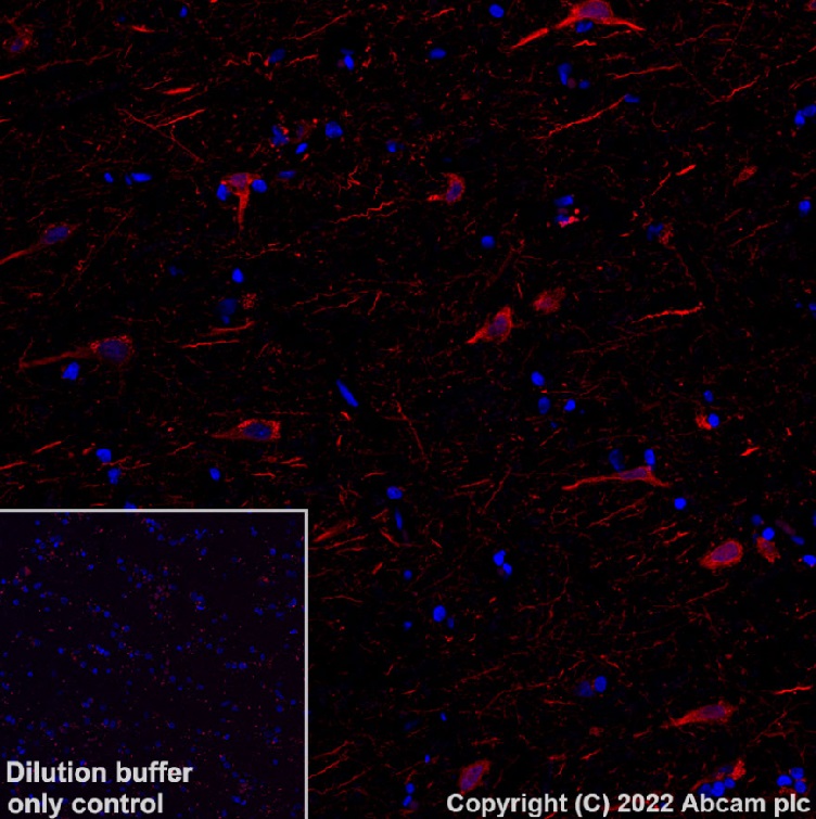 Immunohistochemistry (Formalin/PFA-fixed paraffin-embedded sections) - Alexa Fluor® 568 Anti-MAP2 antibody [EPR19691] (ab303465), expandable thumbnail