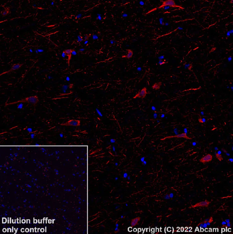 Immunohistochemistry (Formalin/PFA-fixed paraffin-embedded sections) - Alexa Fluor® 568 Anti-MAP2 antibody [EPR19691] - Neuronal Marker (AB303465)