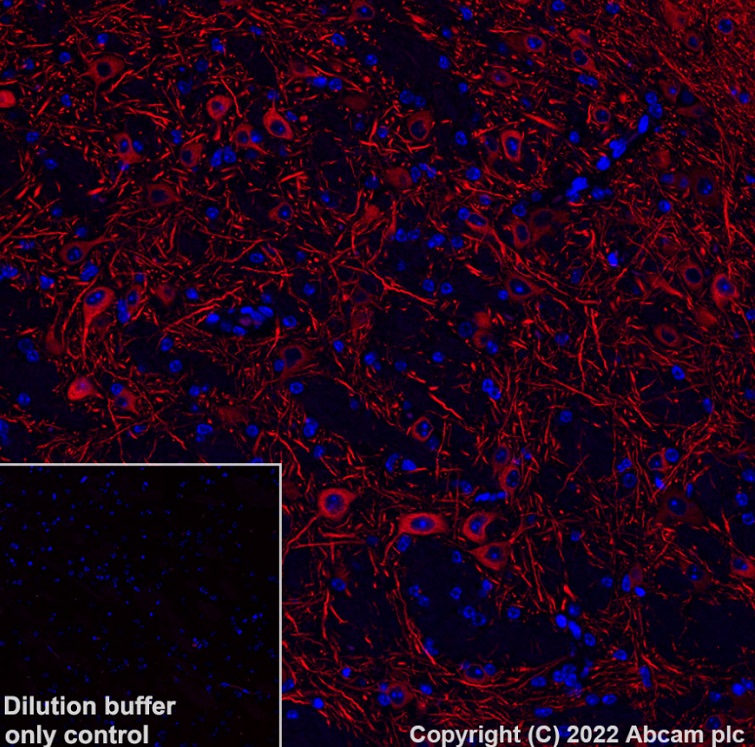 Immunohistochemistry (Formalin/PFA-fixed paraffin-embedded sections) - Alexa Fluor® 568 Anti-MAP2 antibody [EPR19691] (ab303465), expandable thumbnail