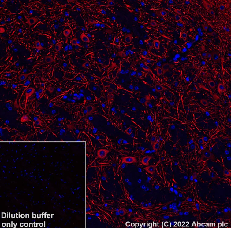 Immunohistochemistry (Formalin/PFA-fixed paraffin-embedded sections) - Alexa Fluor® 568 Anti-MAP2 antibody [EPR19691] - Neuronal Marker (AB303465)