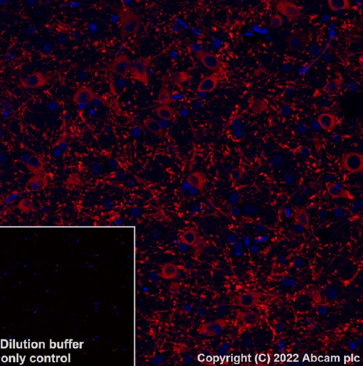 Immunohistochemistry (Formalin/PFA-fixed paraffin-embedded sections) - Alexa Fluor® 568 Anti-MAP2 antibody [EPR19691] (ab303465), expandable thumbnail
