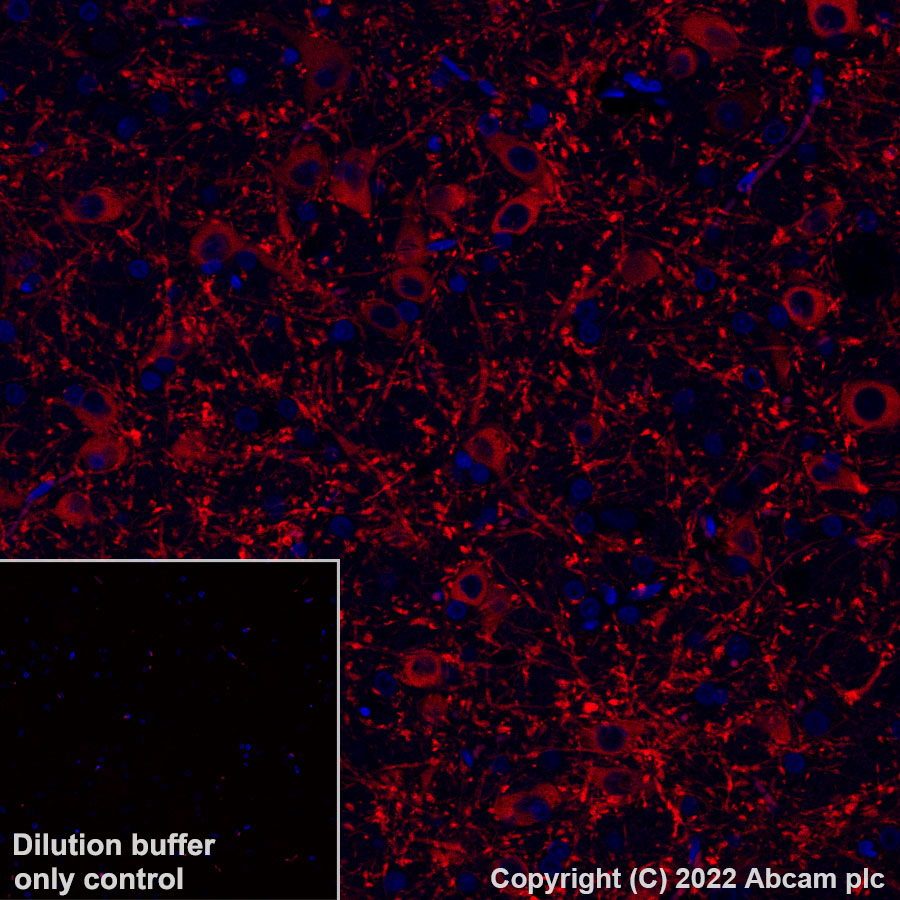 Immunohistochemistry (Formalin/PFA-fixed paraffin-embedded sections) - Alexa Fluor® 568 Anti-MAP2 antibody [EPR19691] (AB303465), expandable thumbnail