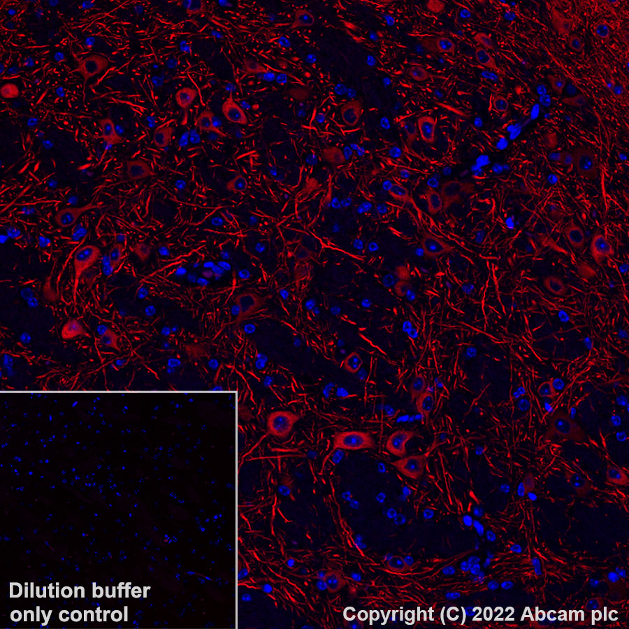 Immunohistochemistry (Formalin/PFA-fixed paraffin-embedded sections) - Alexa Fluor® 568 Anti-MAP2 antibody [EPR19691] (AB303465), expandable thumbnail
