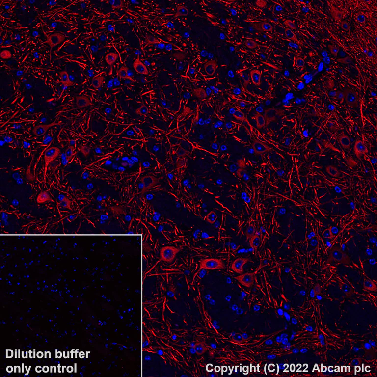 Immunohistochemistry (Formalin/PFA-fixed paraffin-embedded sections) - Alexa Fluor® 568 Anti-MAP2 antibody [EPR19691] - Neuronal Marker (AB303465)