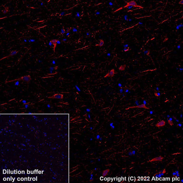 Immunohistochemistry (Formalin/PFA-fixed paraffin-embedded sections) - Alexa Fluor® 568 Anti-MAP2 antibody [EPR19691] - Neuronal Marker (AB303465)