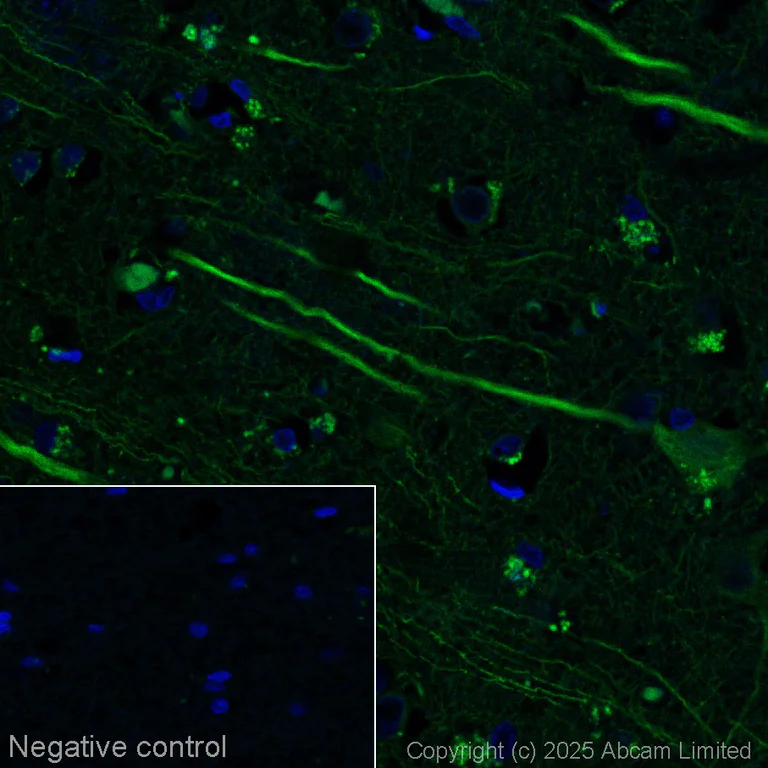 Immunohistochemistry (Formalin/PFA-fixed paraffin-embedded sections) - Alexa Fluor® 568 Anti-MAP2 antibody [EPR19691] - Neuronal Marker (AB303465)