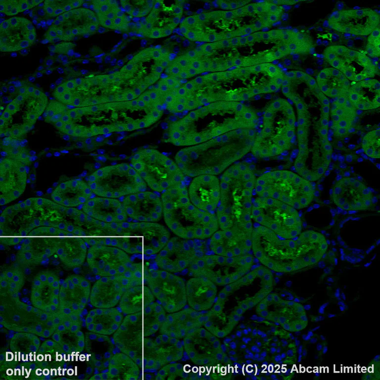 Immunohistochemistry (Formalin/PFA-fixed paraffin-embedded sections) - Alexa Fluor® 568 Anti-ME1 antibody [EPR28891-30] (AB325044)