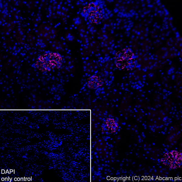 Immunohistochemistry (Frozen sections) - Alexa Fluor® 568 Anti-Nestin antibody [EPR22023] (AB317058), expandable thumbnail