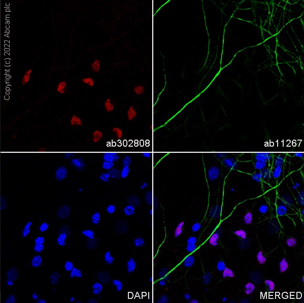 Immunocytochemistry/ Immunofluorescence - Alexa Fluor® 568 Anti-Olig2 antibody [EPR2673] (AB302808), expandable thumbnail