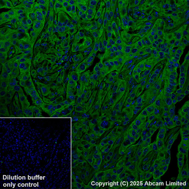 Immunohistochemistry (Formalin/PFA-fixed paraffin-embedded sections) - Alexa Fluor® 568 Anti-PAK1 antibody [EPR26067-45] (AB325259)